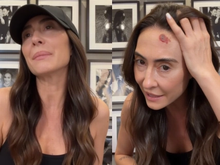 Rocío Martín Berrocal sorprende al revelar su lucha contra el cáncer de piel