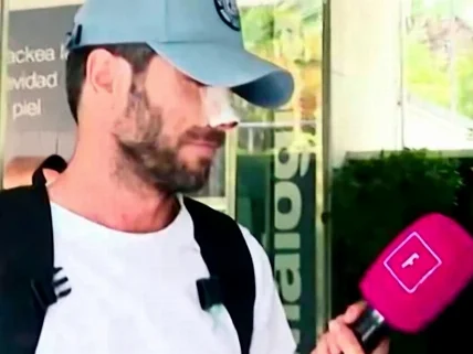 Antonio Canales Rivera reaparece tras su operación en la nariz