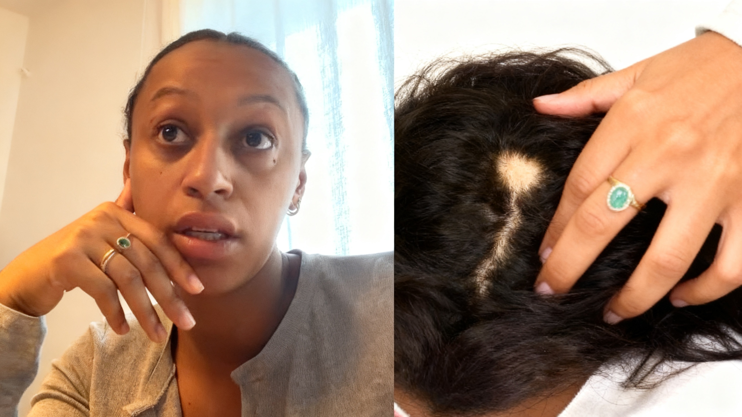 Ana Peleteiro muestra sin tapujos una nueva área de calvicie en la semana 33 de embarazo Español.News
