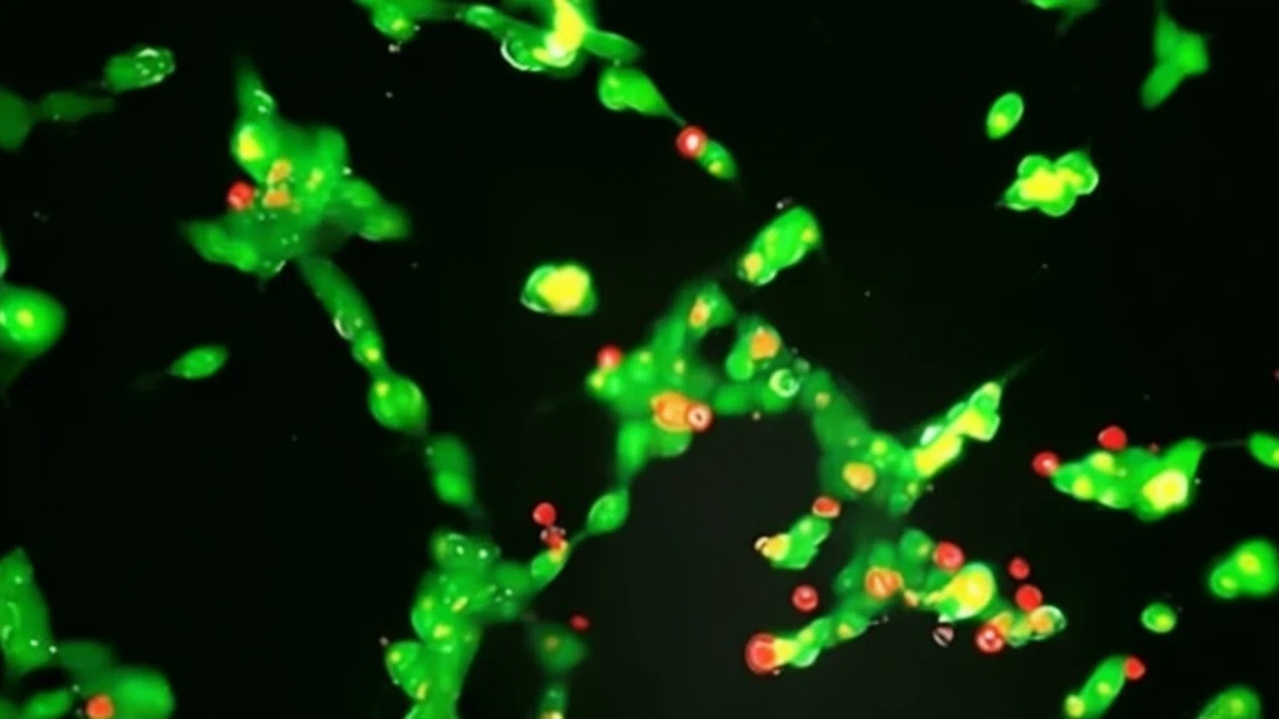 Descubre el avance que podría revolucionar la vida de niños con cáncer Español.News